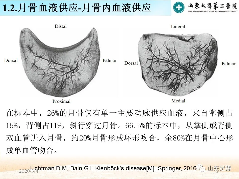 Kienböck’s disease研究进展 - 图11