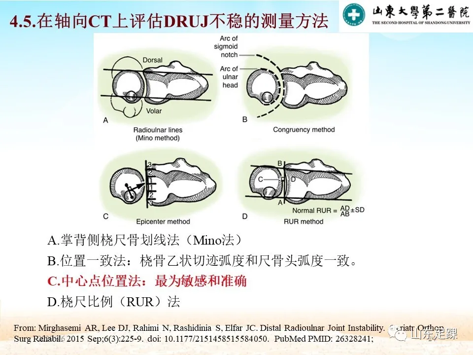 远端尺桡关节（DRUJ）不稳定的诊断与解剖重建 - 图24