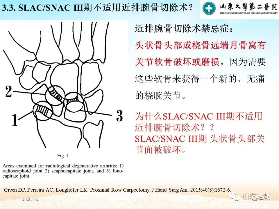 部分腕骨融合VS近排腕骨切除如何选择 - 图22