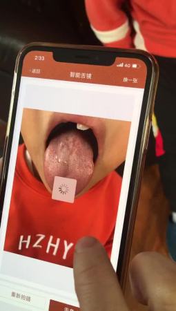 国医慧联-智能舌镜使用方法.mp4 (15.08MB)