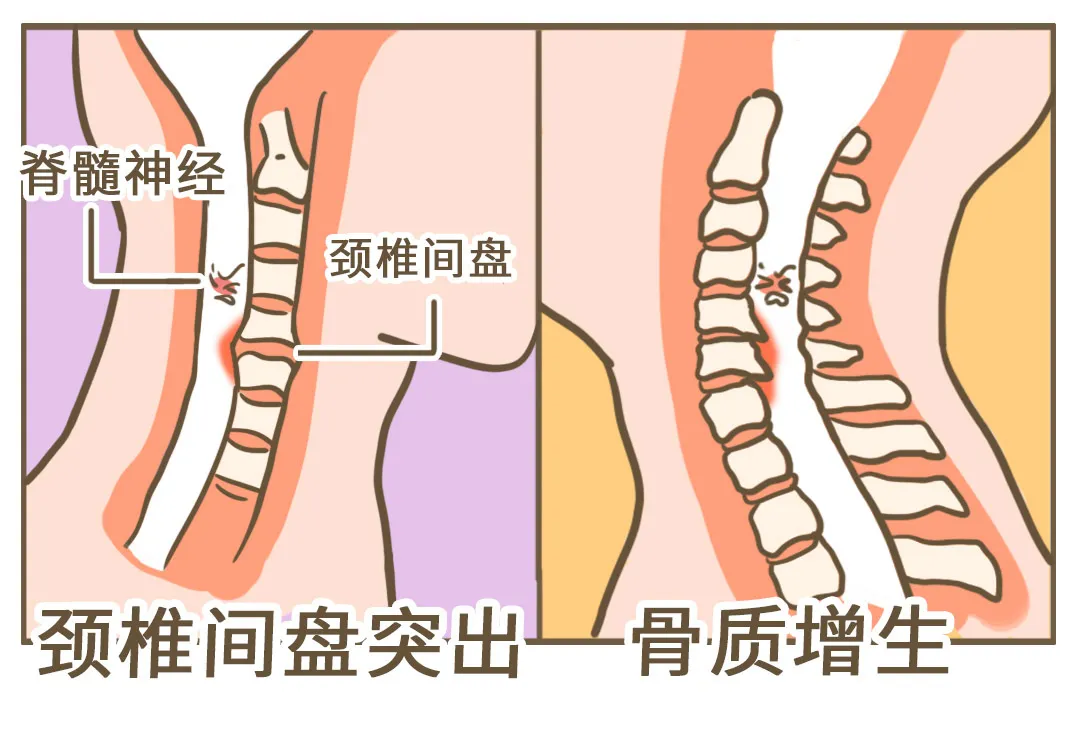 矫正身姿 - 图4