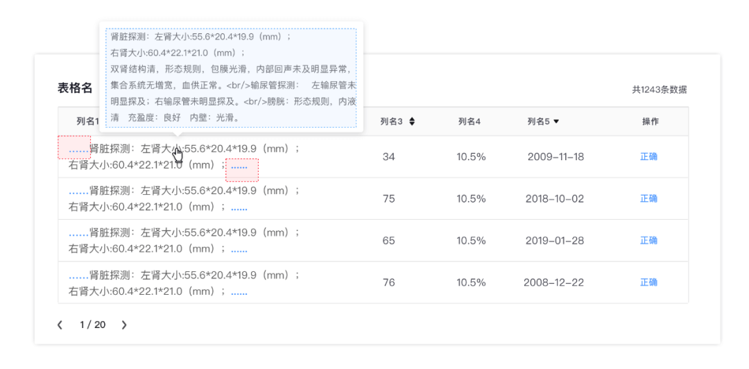 B端设计｜数据展示控件应用 - 图5