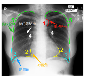 SCAN:结构校正对抗网络用于胸部X光图像分割 论文笔记 - 图8