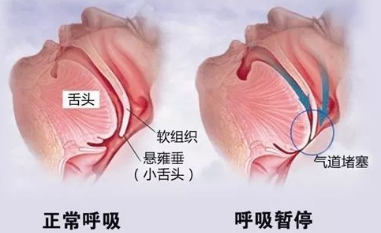 健康指南 - 图14